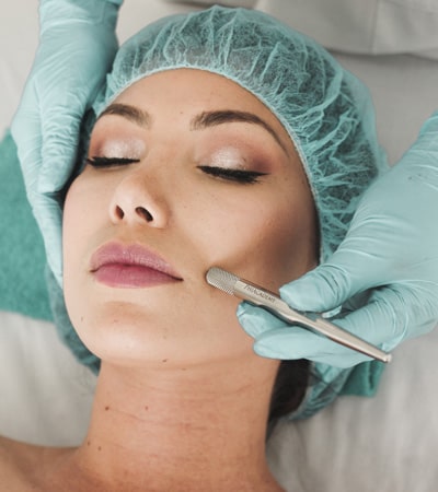 لیزر موهای زائد